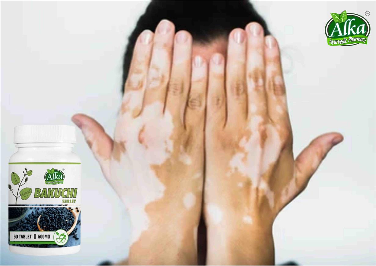Pure Bakuchi Tablet  (Psoralea Corylifolia) for Vitiligo-White Skin Patches